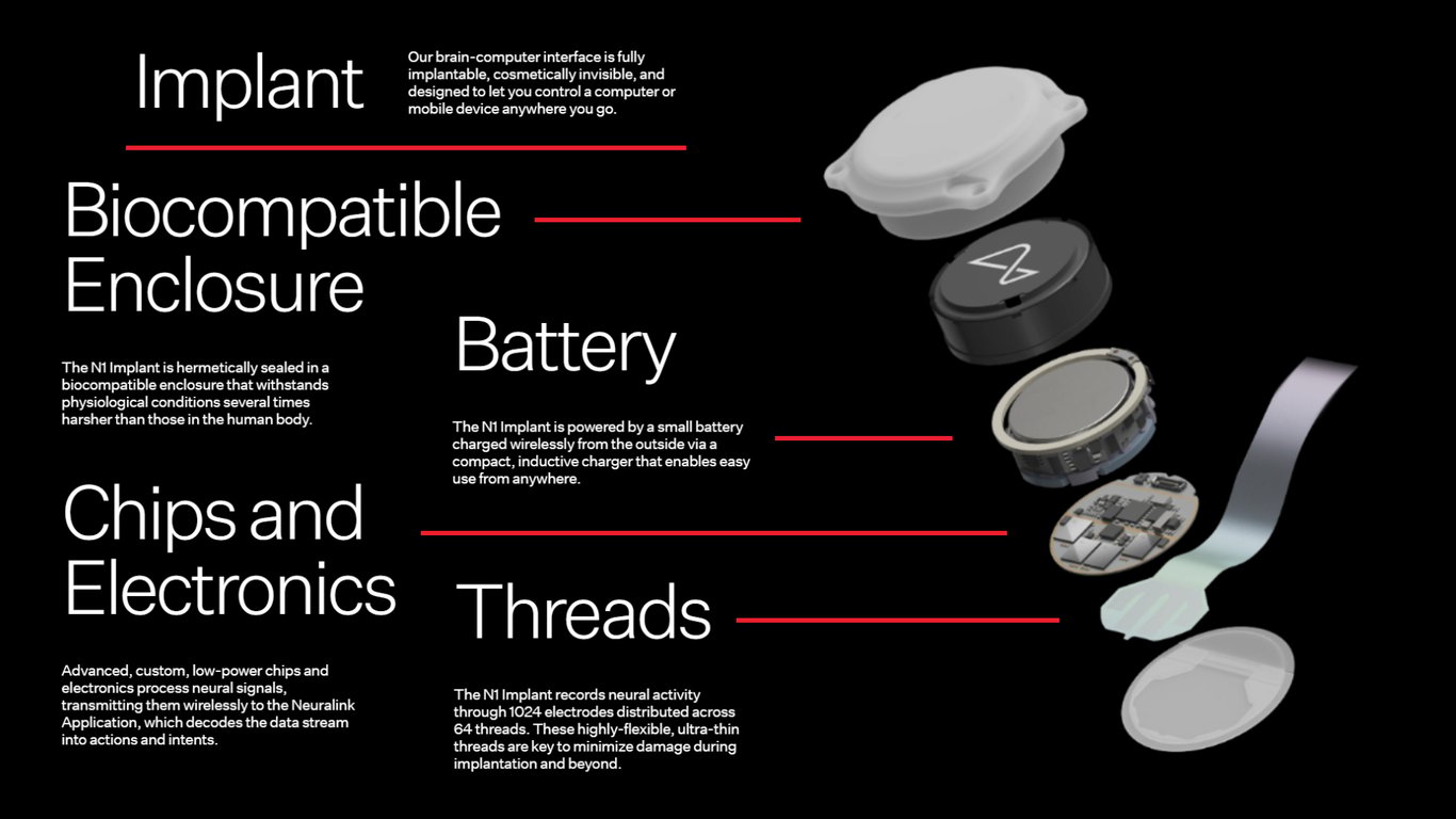 TechDogs-"An Image Depicting The Various Components Of Neuralink's BCI Implant"