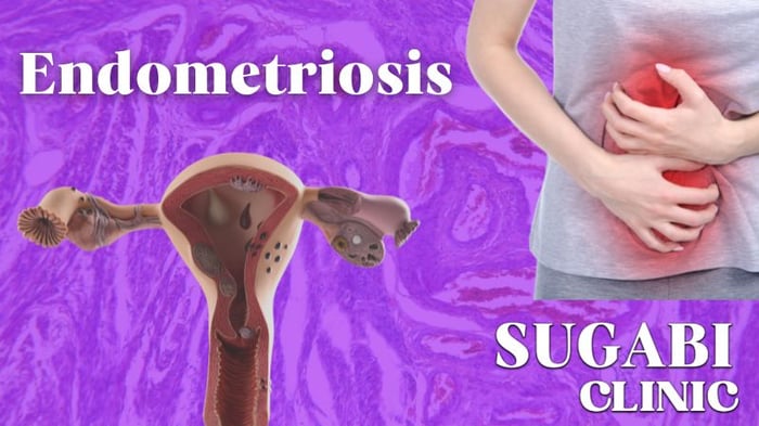 Endometriosis: Symptoms, Diagnosis and Treatment