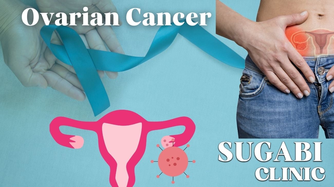 Ovarian Cancer Sugabi Clinic