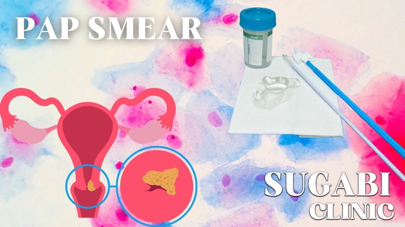 Pap smear test @ Sugabi Clinic Ragama