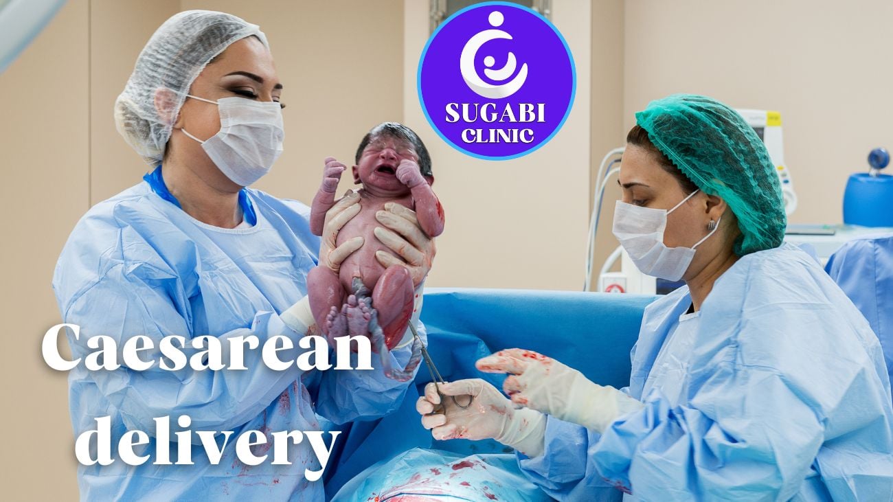 Caesarean Delivery Understanding CSection baby Delivery