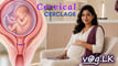 cervical-cerclage-sinhala