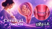 cervical-cerclage-sinhala