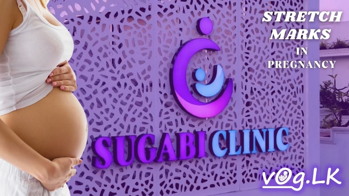 Stretch Marks Pregnancy Sugabi Clinic