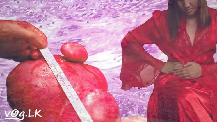 කාන්තා රෝග ගැන දැන ගන්න