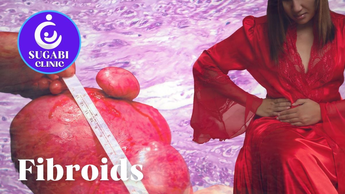 Sugabi Clinic Fibroids