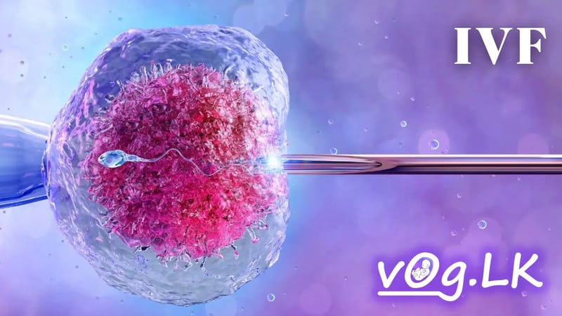 දරු සම්පත් පමාවන අයට පිහිට වෙන IVF ප්‍රතිකාර ක්‍රමය ගැන. (In Vitro Fertilization)