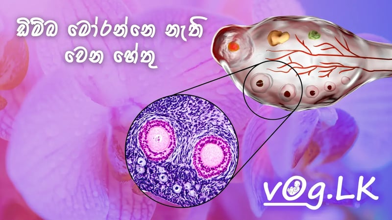 ඩිම්බ මෝරන්නෙ නැති වෙන හේතු