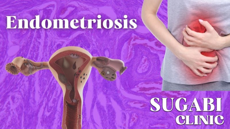 endometriosis