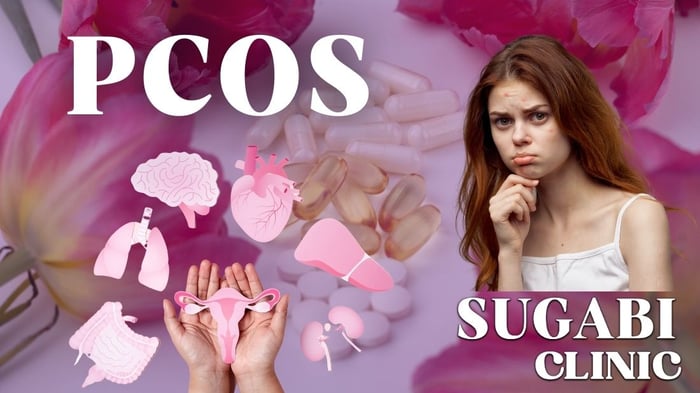 Polycystic Ovary Syndrome (PCOS): Symptoms, Diagnosis and Management