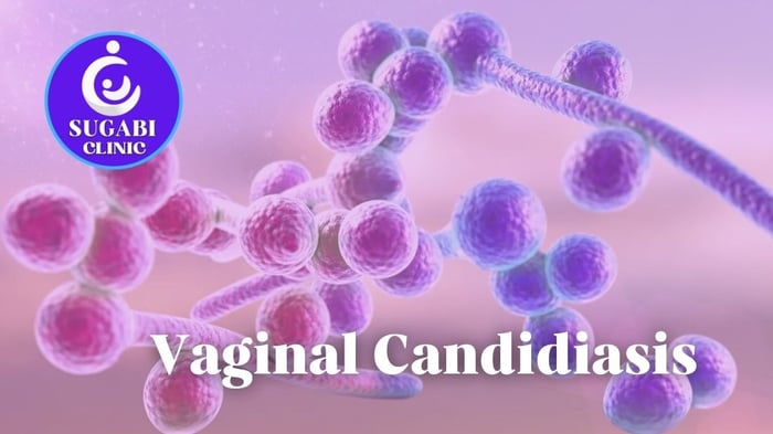Vaginal Thrush (Candidiasis): Symptoms, Treatment and Prevention