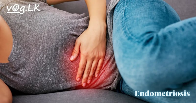 Endometriosis