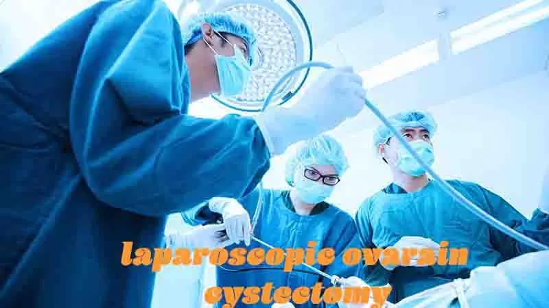 ඩිම්බ කෝෂ වල ගෙඩි සඳහා සිදු කරන ලැපරොස්කොපි ශල්‍ය කර්ම. Laparoscopic surgery for ovarian cysts