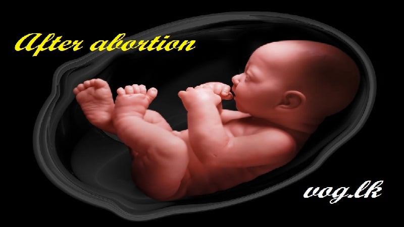 ගබ්සාවකට පසු නැවත ගැබ් ගැනීමට උපදෙස්.