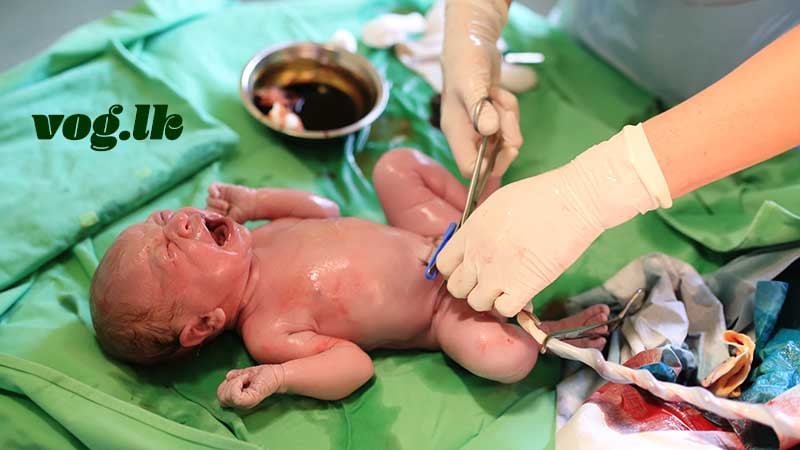 සාමාන්‍ය ප්‍රසූතිය ඉක්මන් කරන ක්‍රම. (Induction of labour)