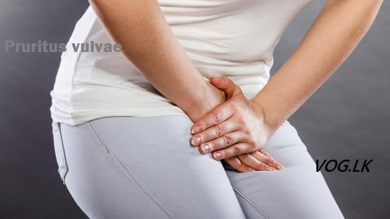 යෝනි විවරය අවට දැවිල්ල සහ ආසාදන ( Pruritus Vulvae)