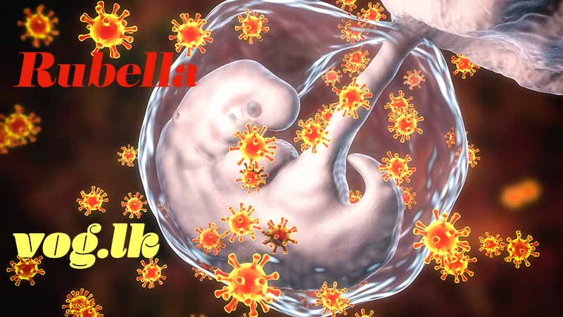 නූපන් දරුවාට හානි කරන රුබෙල්ලා වෛරස ආසාදනය