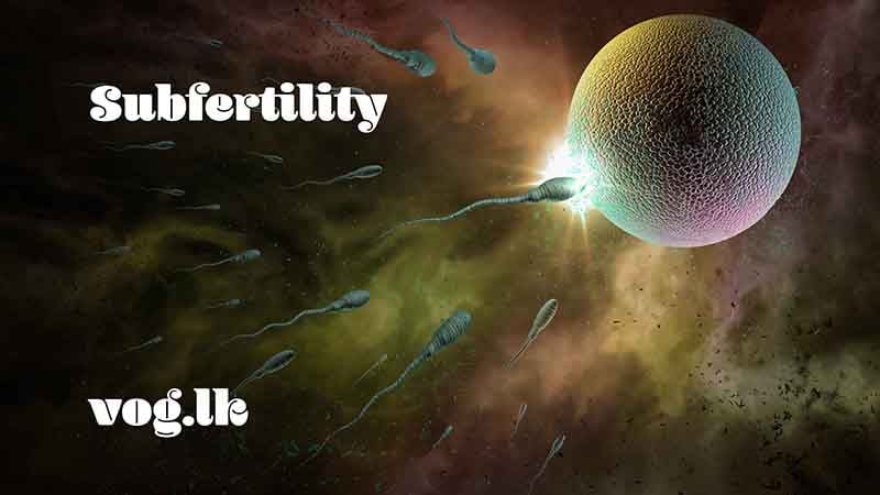 මද සරු බවට හේතු සහ ප්‍රතිකාර (Subfertility)
