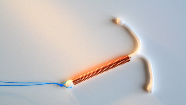 අන්තර් ගර්භාෂිත ලූපය (IUD)