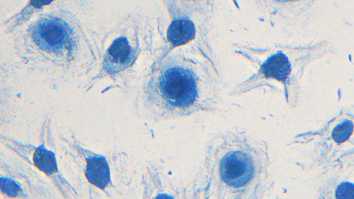 Understanding senescent cells: how to get rid of these zombie cells