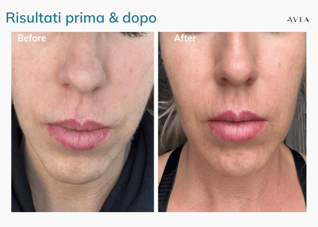 AVEA Collagen Activator esperienza