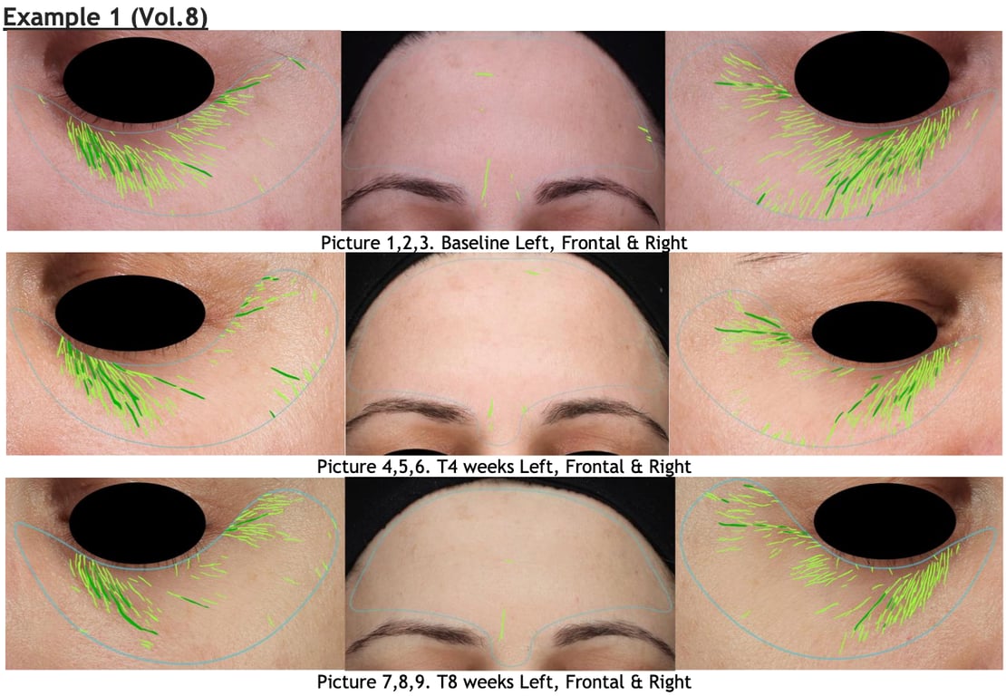 SKINSPANⓇ Advanced Skin Serum: An 8-Week Clinical Evaluation of Wrinkle Reduction, Skin Elasticity, and Barrier Function in Adults Aged 35–65