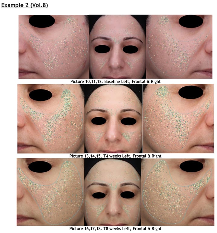 SKINSPANⓇ Advanced Skin Serum: An 8-Week Clinical Evaluation of Wrinkle Reduction, Skin Elasticity, and Barrier Function in Adults Aged 35–65