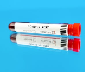 Akıllı telefon ile yapılabilen Covid 19 testi geliştirildi