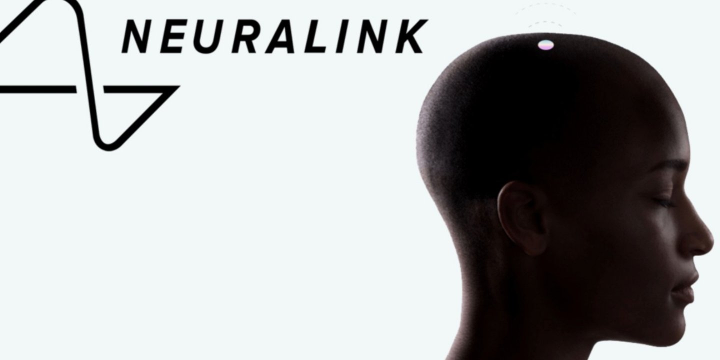 Elon Musk'ın Neuralink projesi kötüye gidiyor 65 Elon Musk'ın Neuralink projesi kötüye gidiyor