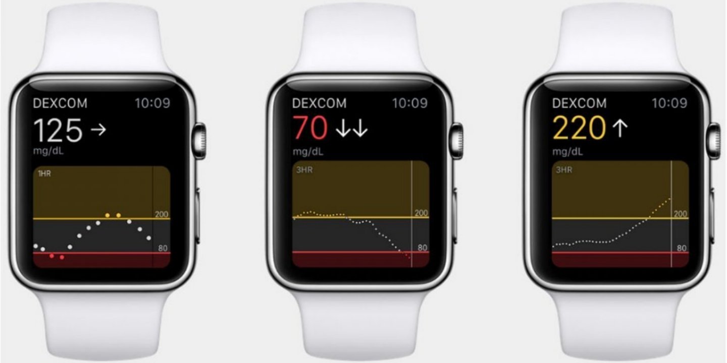 Giyilebilir teknoloji pazarının lideri Apple Watch oldu
