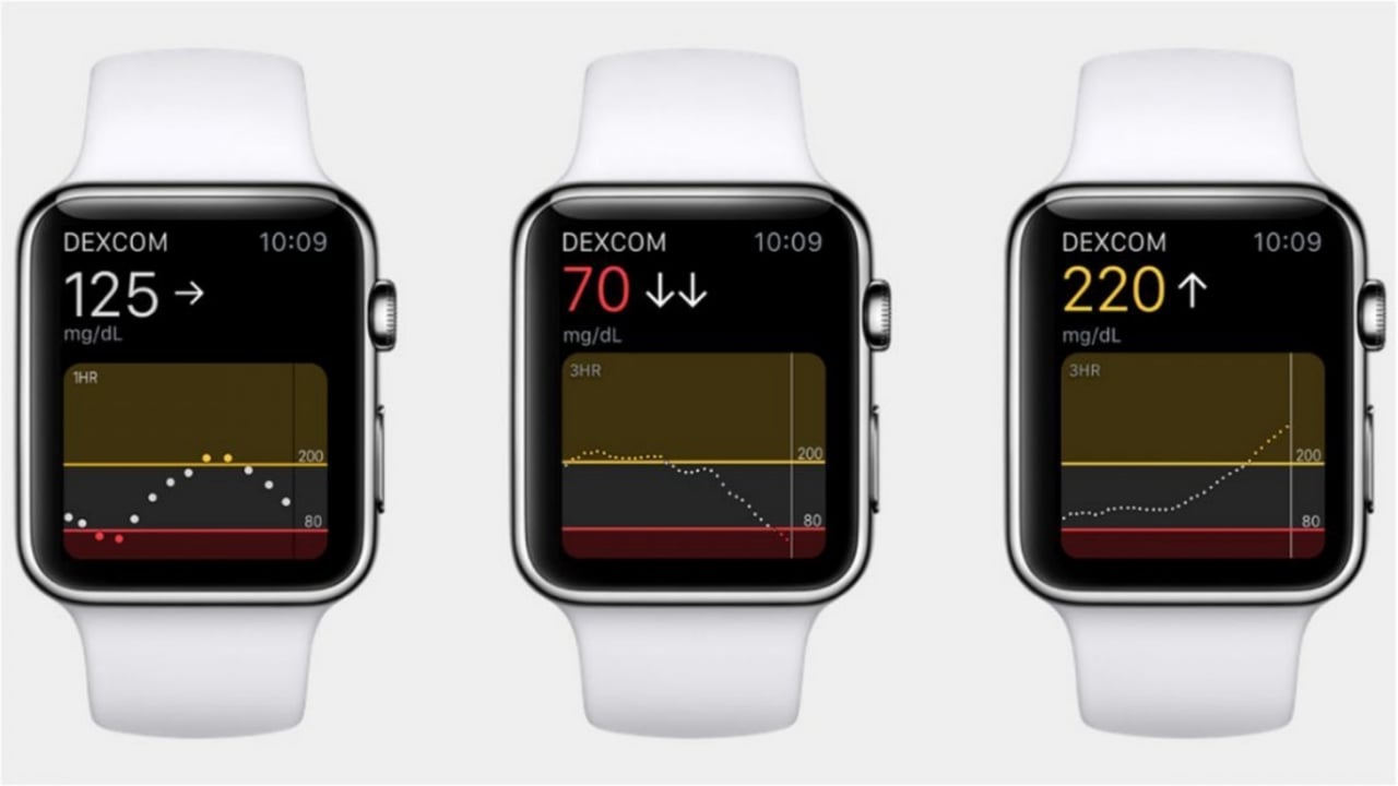 Apple Watch Ultra için yeni pil güncellemesi