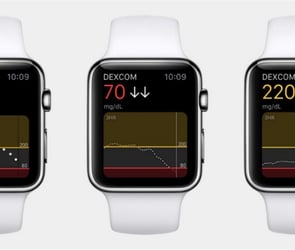 Apple Watch Ultra için yeni pil güncellemesi