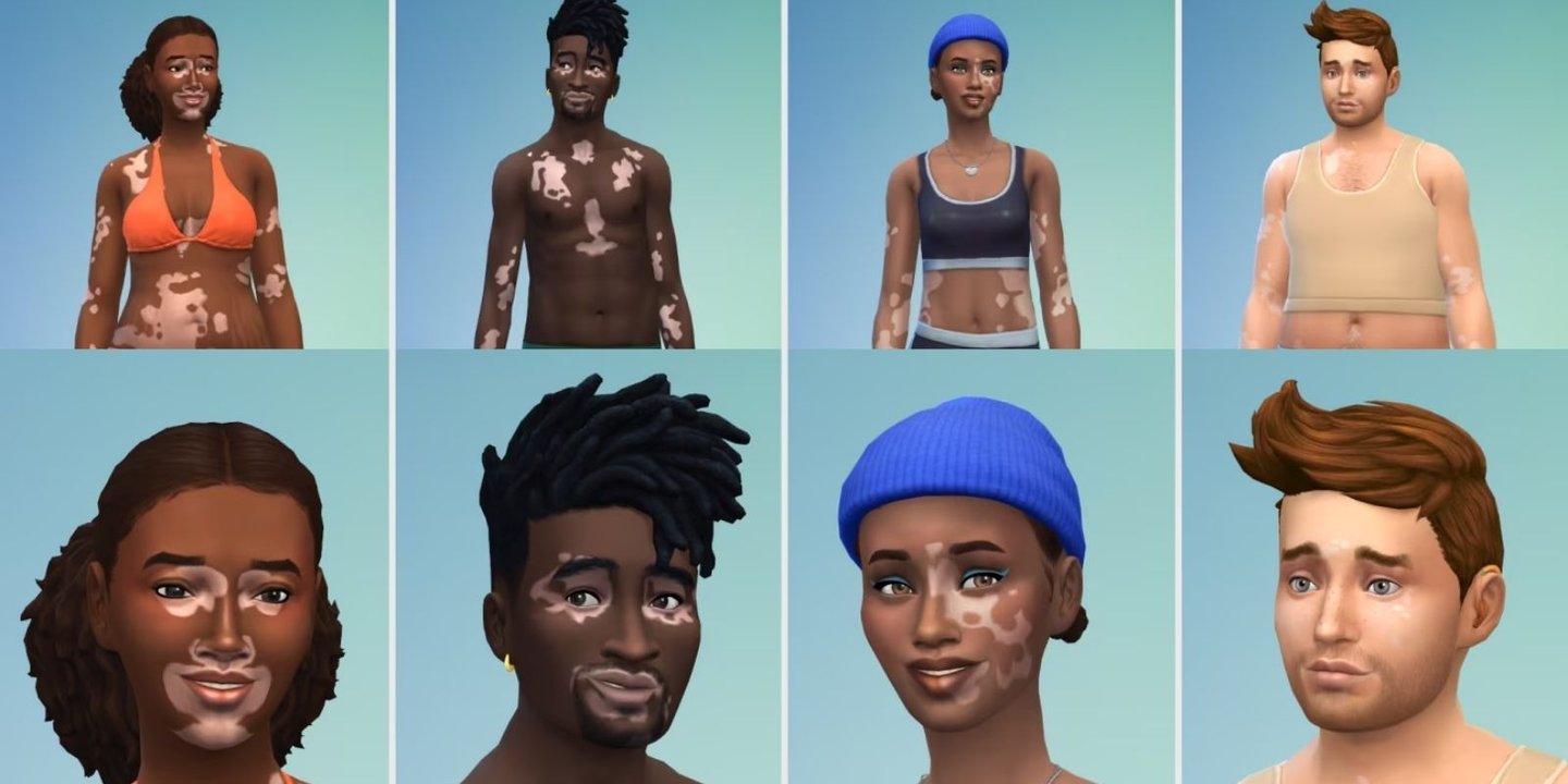 Sims 4'te Vitiligo Adıyla Yeni Güncelleme Duyuruldu