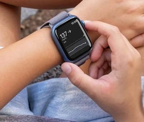 Dexcom G7 ile Sağlık Değerleri Takibi Artık Apple Watch'ta!