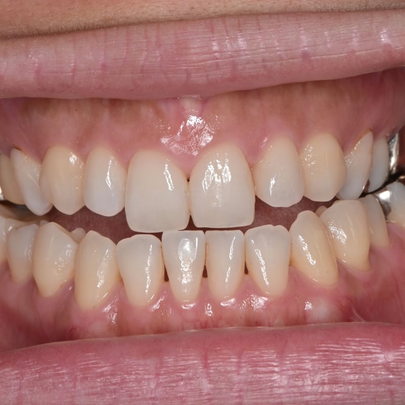 Z50口腔内写真用ミラーレスカメラ(書籍付) | Camera for DENTAL