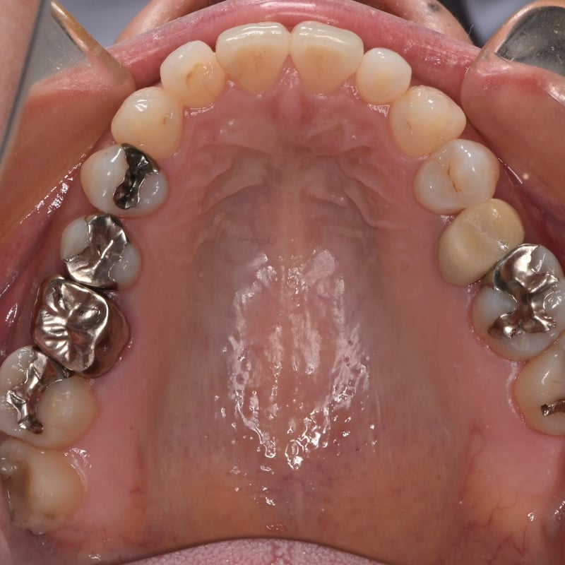 Z50口腔内写真用ミラーレスカメラ(書籍付) | Camera for DENTAL Z50口腔内写真用ミラーレスカメラ(書籍付) | Camera for DENTAL