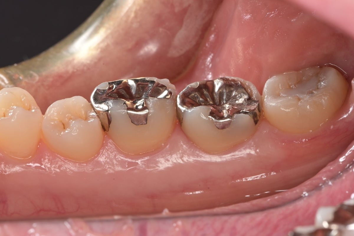 Z50口腔内写真用ミラーレスカメラ(書籍付) | Camera for DENTAL