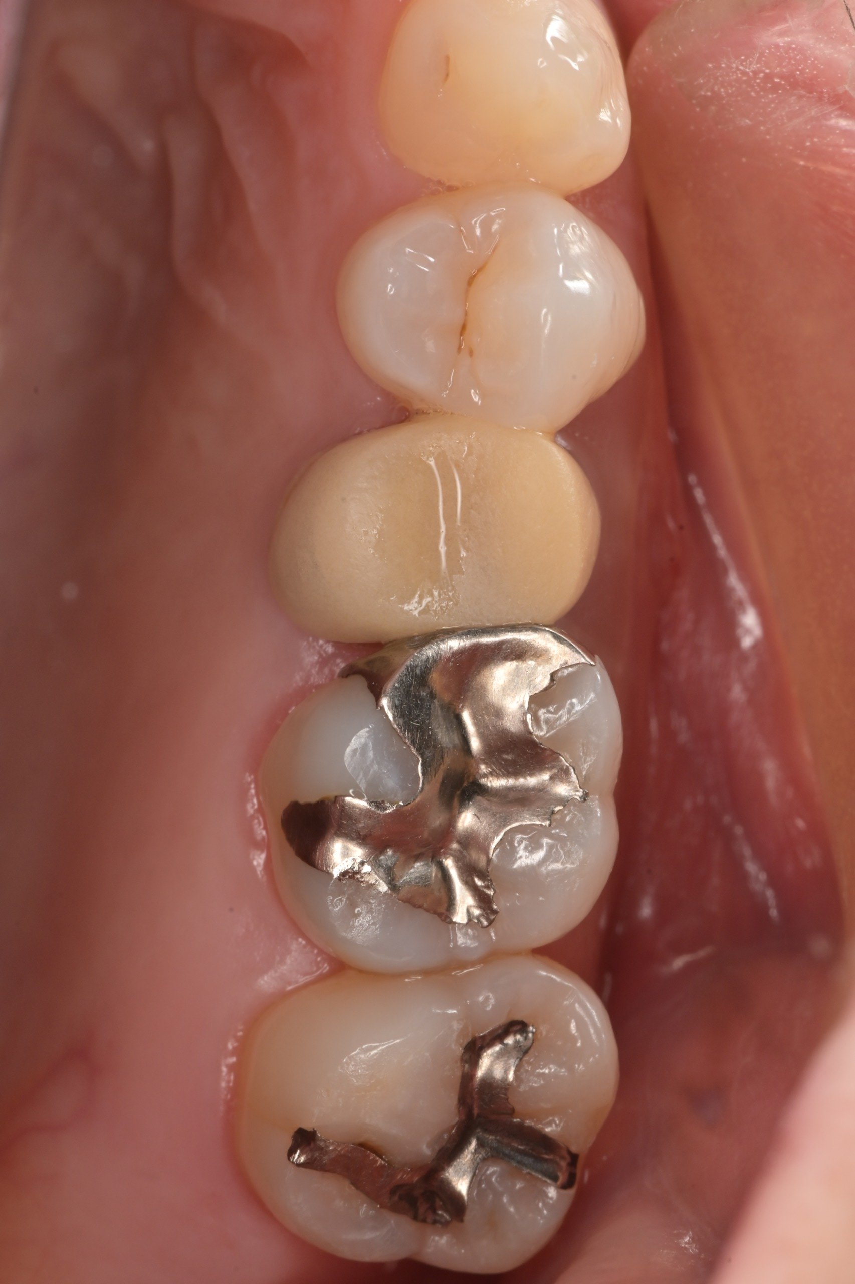 Z50口腔内写真用ミラーレスカメラ(書籍付) | Camera for DENTAL