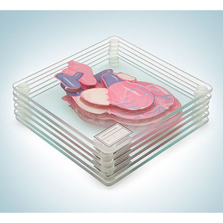 Anatomic Heart Specimen Coasters