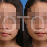 証明写真の顔のパーツ修整修整・修正・加工（目・鼻・口のうち1箇所1修整）