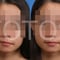 証明写真の顔のパーツ修整修整・修正・加工（目・鼻・口のうち1箇所1修整）