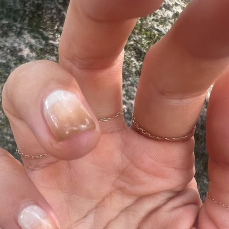 skin chain ring 10k