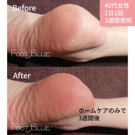 fori（フォーアイ）モイスチャーフットクリーム　66g