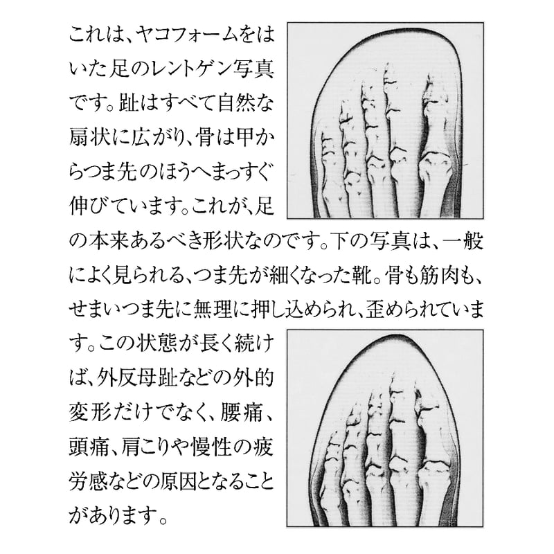 ヤコフォーム❣️ショートブーツ　エルクレザー 25cm　コンフォートシューズ ヤコフォーム❣️ショートブーツ エルクレザー 25cm コンフォートシューズ
