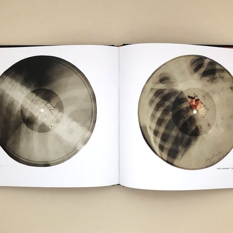 X-RAY AUDIO