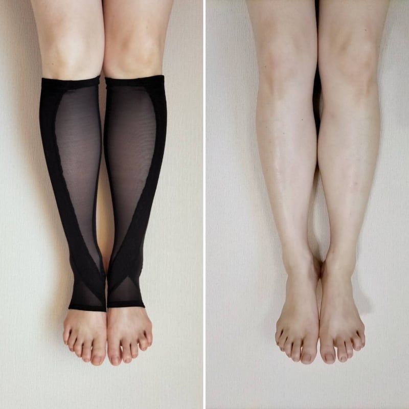 弾性ストッキング　インフィッシュHS+ (男女兼用) 一般医療機器 インフィッシュHS⁺（一般医療機器・着圧ハイソックス