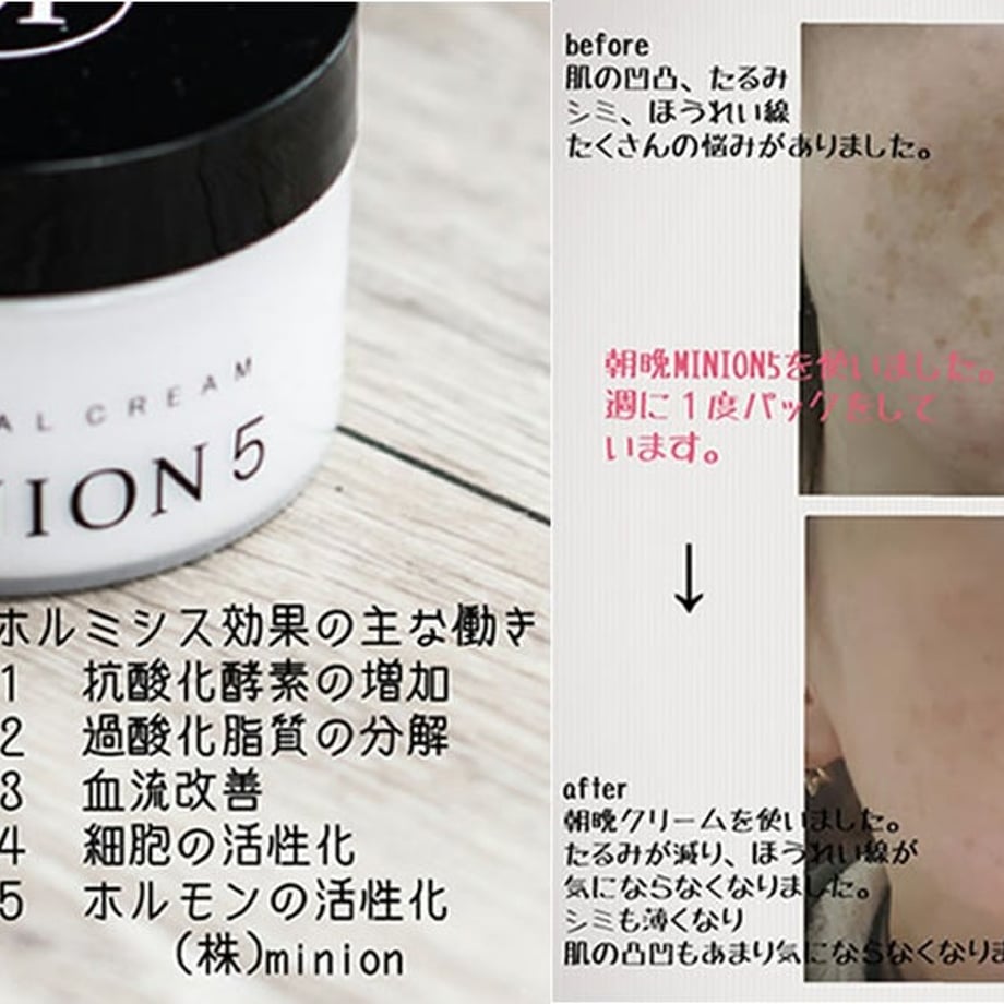 56eccc8d2b3492e3c7005751
