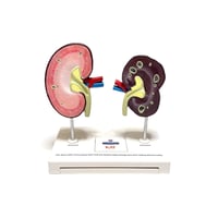 【USED】Vintage Hill’s PRESCRIPTION DIET Anatomical Model of Dog Kidney