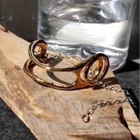 Fibula bangle