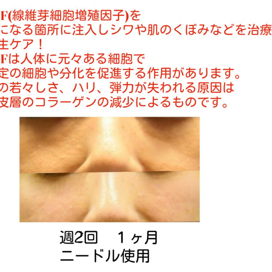 60389957c19c455cbcbf2d23
